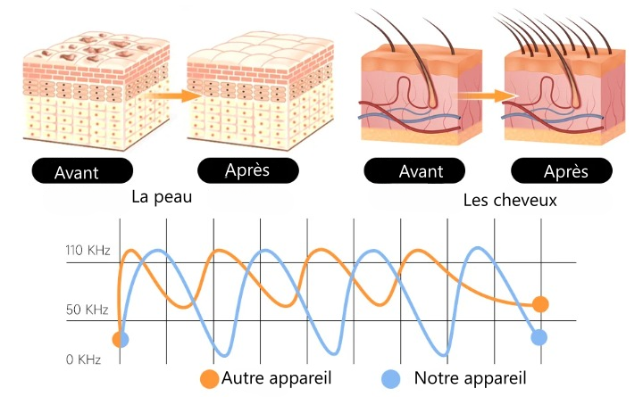 Appareil haute fréquence en verre 6 en 1 pour soins visage anti-rides anti-âge raffermissement de la peau et traitement d’acné