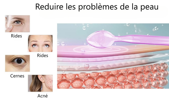 Appareil haute fréquence en verre 6 en 1 pour soins visage anti-rides anti-âge raffermissement de la peau et traitement d’acné