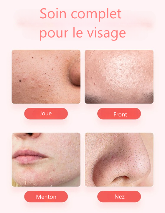 Épurateur de peau à ultrasons pour visage 4 en 1 nettoyeur de points noirs soins visage